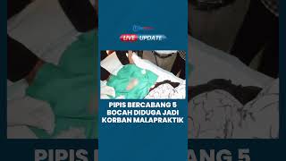 Pipis Bercabang 5 susai Ikut Sunat Massal, Seorang Bocah di Palembang Diduga Jadi Korban Malapraktik