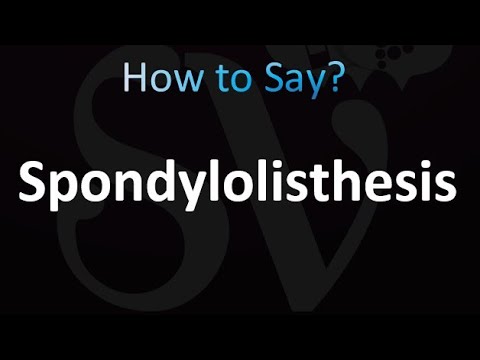 How to Pronounce Spondylolisthesis (correctly!)