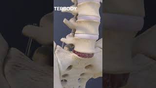 Download lagu Advantages of an L5-S1 Anterior Lumbar Interbody Fusion mp3 Download lagu Advantages of an L5-S1 Anterior Lumbar Interbody Fusion mp3