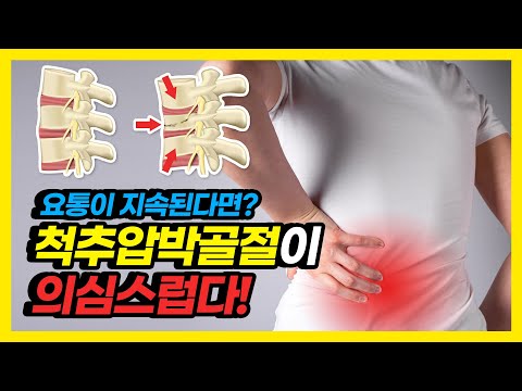 요통이 지속된다면? 척추압박골절이 의심스럽다!