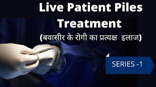 Piles Treatment || Live || (बवासीर के रोगी का प्रत्यक्ष इलाज) || Series 1