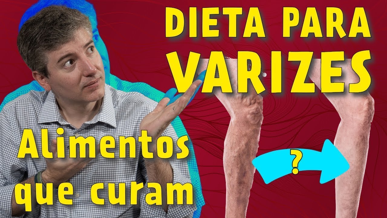 Quais os Alimentos que Combatem as Varizes?