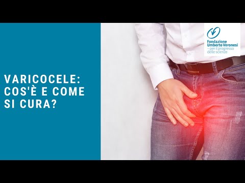 Iodio pene Novosibirsk in farmacia per la potenza