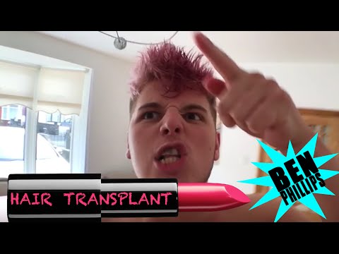 ベン・フィリップス｜植毛PRANK - エリオットがついに出てきた (Ben Phillips | Hair Transplant PRANK - Elliot's finally come out)