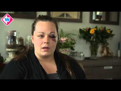 Mishandelde vrouw in Zoetermeer waarschuwt andere meiden voor zinloos geweld tijdens uitgaan