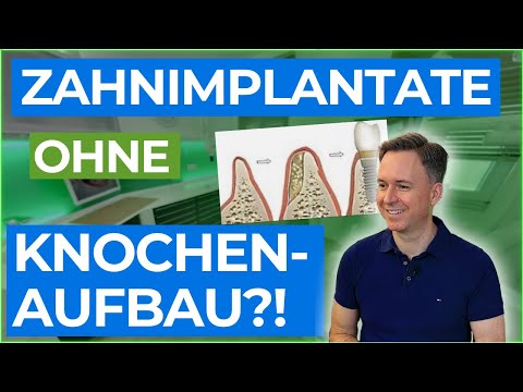 Implantate ohne Knochenaufbau? Ich zeige dir, wie!