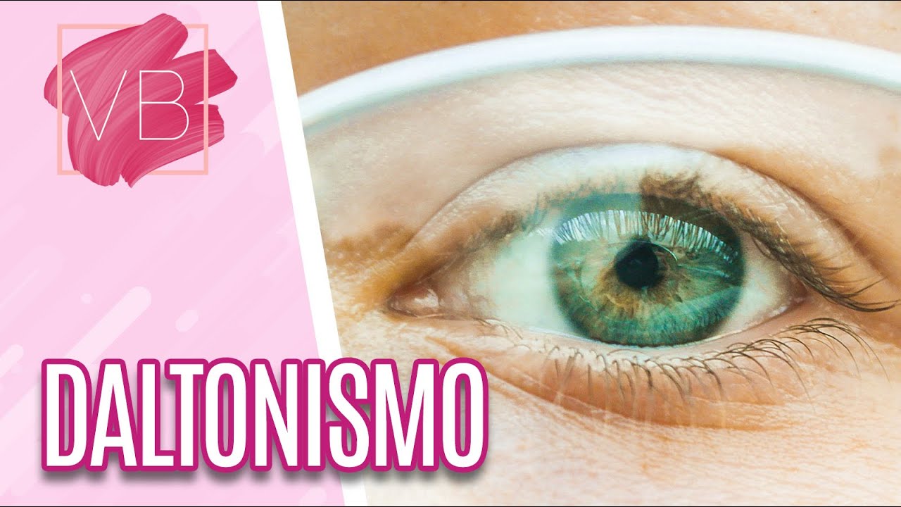 Daltonismo: tipos, causas e tratamentos - Você Bonita (30/01/20)