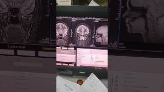 mri brain orbit imaging