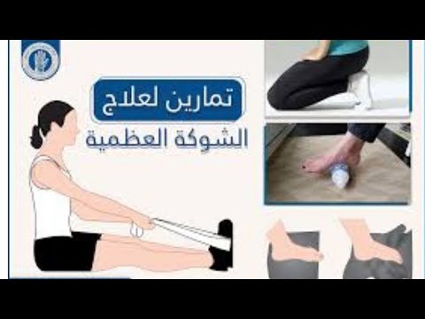  تعرف علي تمارين الشوكة العظمية بالفيديو
