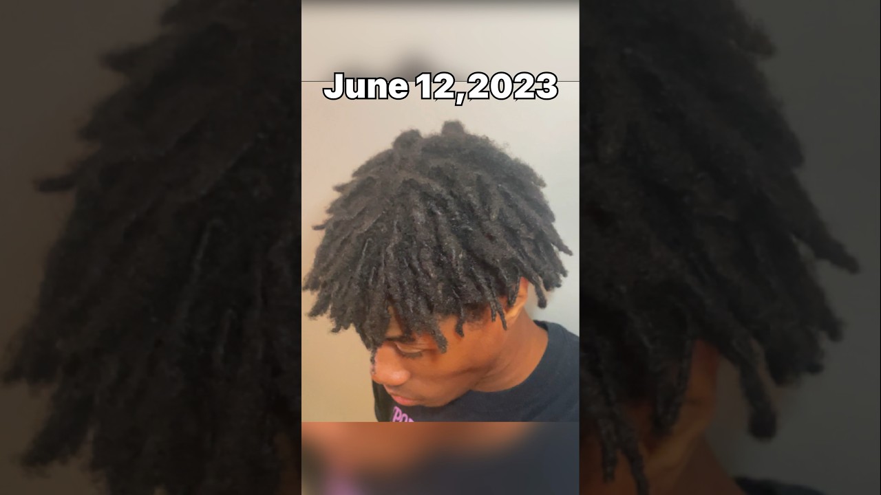 My 1 year dread journey #shorts #short #dreadjourney #dreads #freeformdreads #locs #kaicenat