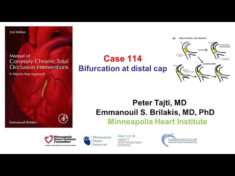 Case 114: Manual of CTO Interventions: Bifurcation at distal cap