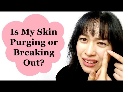 Is My Skin Purging or Breaking Out? | Lab Muffin Beauty Science