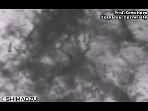 High-Speed Video Camera HPV-X2 – "2 mm from the nozzle"