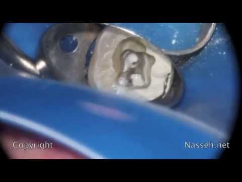 download lagu mp3 mp4 Bc Sealer, download lagu Bc Sealer gratis, unduh video klip Bc Sealer