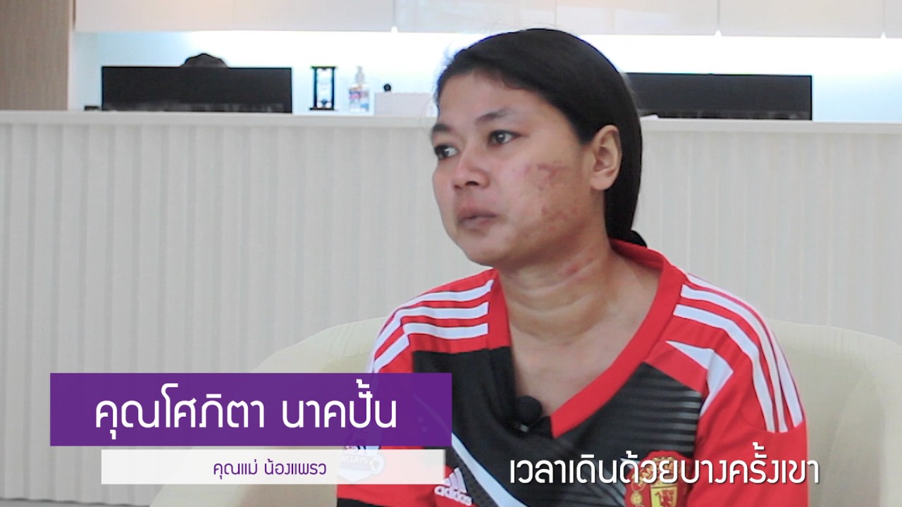 V-Multiplex เทคโนโลยีเลเซอร์ช่วยรักษาแผลเป็น ศูนย์ความงามและเลเซอร์ โรงพยาบาลลาดพร้าว