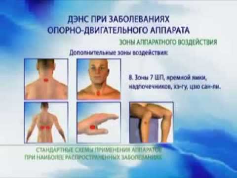 После бассейна болит тазобедренный сустав Почему болят локтевые суставы видео