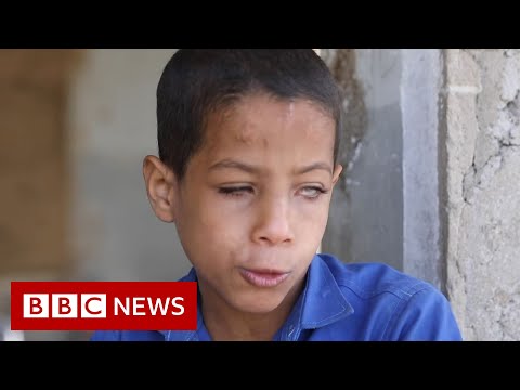 イエメンの盲目の9歳の教師 - BBC ニュース (Yemen's blind nine-year-old war-zone school teacher - BBC News)