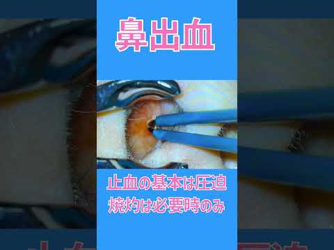 犬の鼻血を止める方法