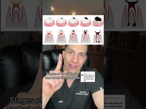 Stages of Decay Where You Can Reverse or Can NOT!