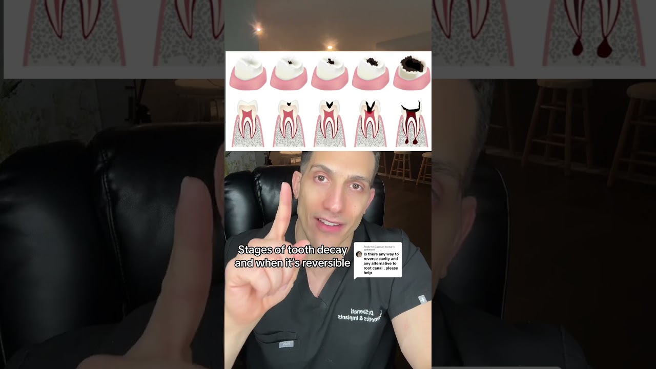 Stages of Decay Where You Can Reverse or Can NOT!