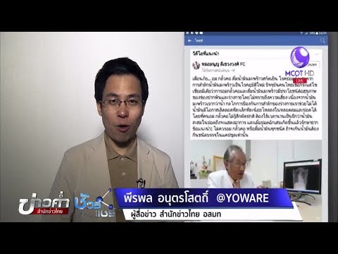 SDA ยาเสพติดในการรักษาโรคสะเก็ดเงิน ด่างทับทิมและโรคสะเก็ดเงิน