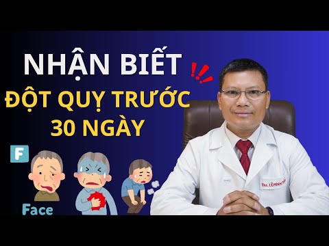 10 dấu hiệu đột quỵ sớm trước 30 ngày bạn cần biết