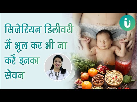 download lagu mp3 mp4 Cesarean Delivery Ke Baad Kya Khana Chahiye, download lagu Cesarean Delivery Ke Baad Kya Khana Chahiye gratis, unduh video klip Cesarean Delivery Ke Baad Kya Khana Chahiye