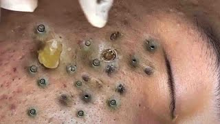 𝑅𝑒𝑐𝑙𝑎𝑖𝑚 𝑌𝑜𝑢𝑟 𝐺𝑙𝑜𝑤 𝐴𝑛𝑑 𝐶𝑎𝑙𝑚 𝑇ℎ𝑟𝑜𝑢𝑔ℎ 𝑀𝑖𝑛𝑑𝑓𝑢𝑙 𝑆𝑘𝑖𝑛𝑐𝑎𝑟𝑒 𝑀𝑜𝑚𝑒𝑛𝑡𝑠 656853