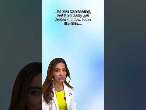 DERMATOLOGIST REACTS TO VIRAL TIKTOK "SCAR GIRL"