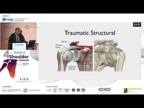 The Stanmore Triangle taking everything into consideration - Dimitrios Alexakis
