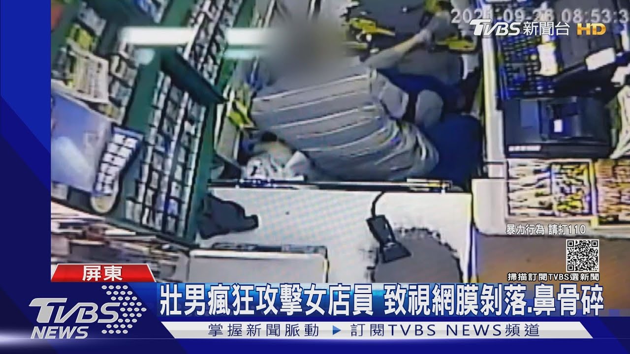 太可惡!壯男瘋狂攻擊女店員 導致視網膜剝落、鼻骨碎裂