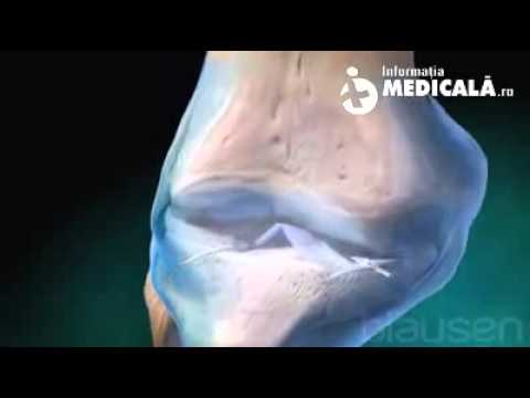 picioarele umflate și articulațiile doare unguent pentru osteochondroza colului uterin