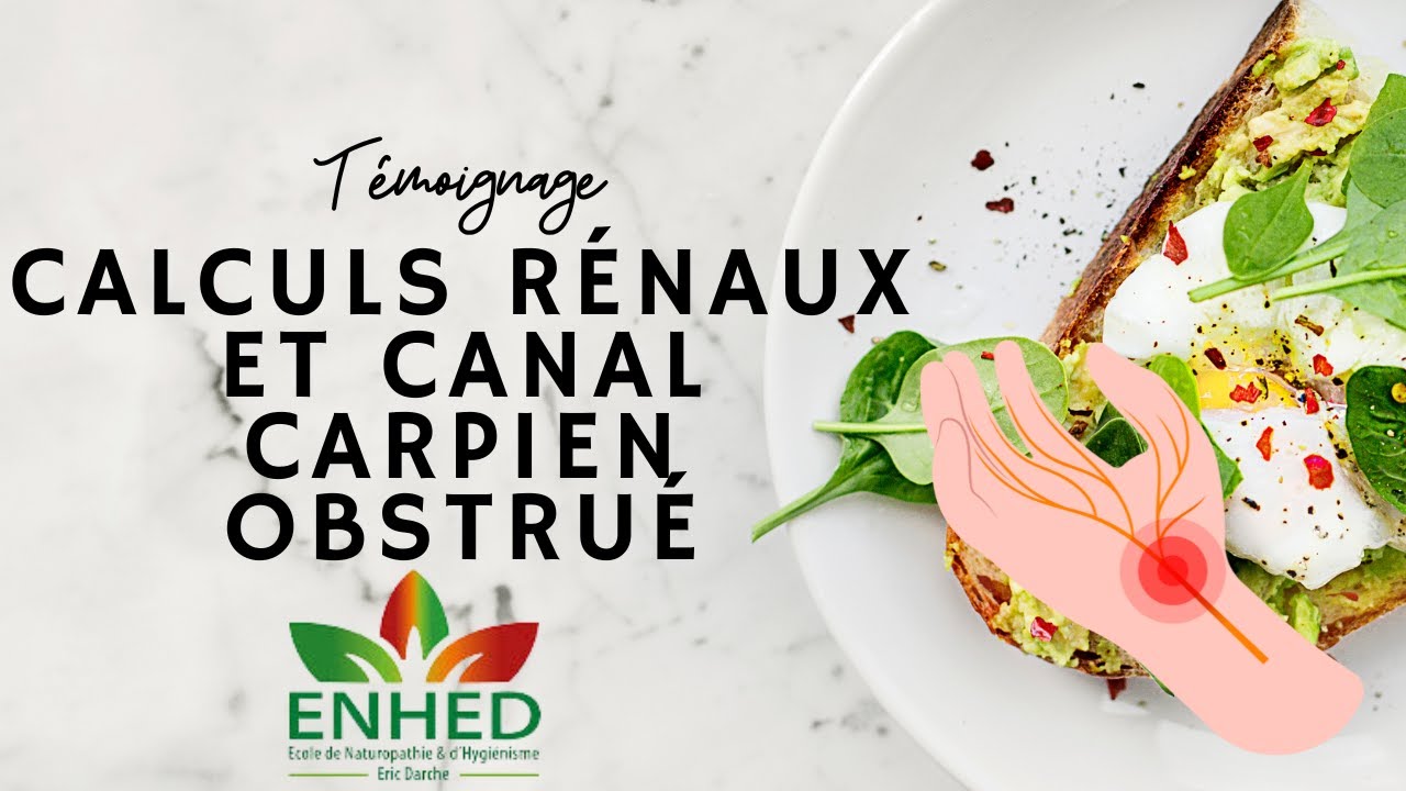 Calculs rénaux et canal carpien obstrué : que peut faire la naturopathie hygiéniste ? (témoignage)