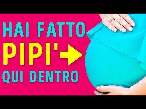Fastidiosa lombalgia nelle donne in restituendo Trattamento curativo suono delle articolazioni
