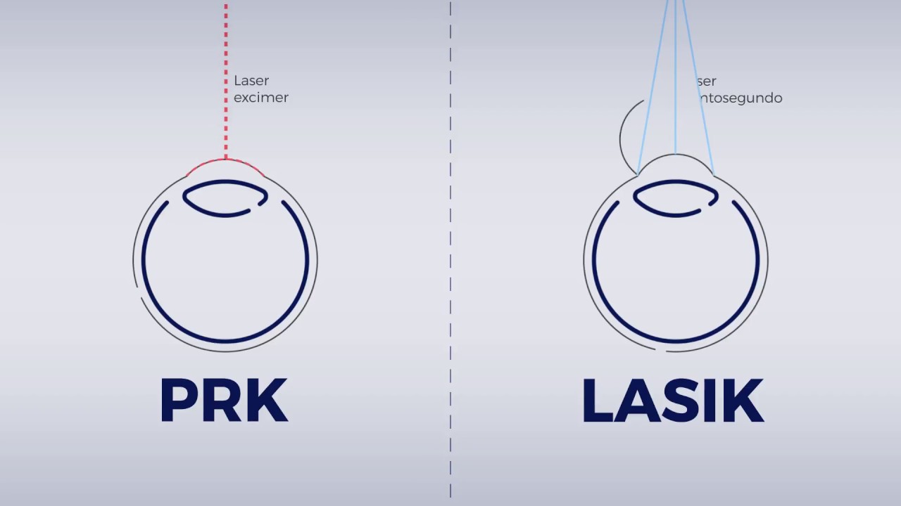 Álvaro Rodríguez Ratón-7