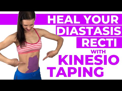 Best Exercises for Diastasis Recti Postpartum Ab Workout