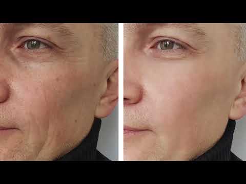 Metron Ariston… My Philosophy