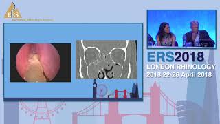 ERS London 2018, Revision Sinus Surgery, Panel Discussion