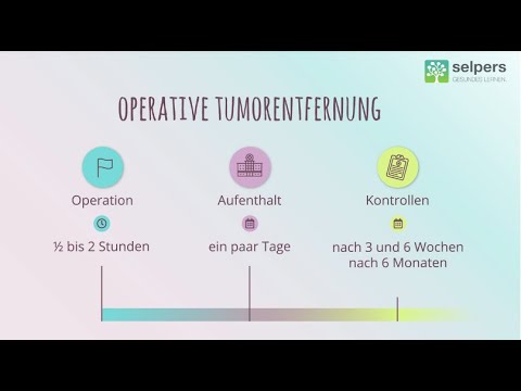 Diese Behandlungsmöglichkeiten gibt es bei Akromegalie - Akren vergrößert Therapie