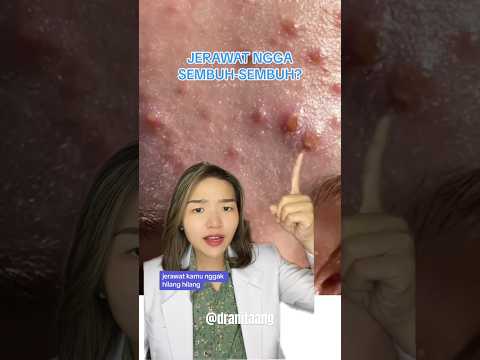 REASONS WHY ACNE DOESN'T HEAL‼️ #skincaretips #acne #aestheticdoctor #sweetfood