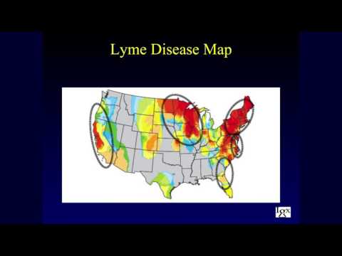 Robert Giguere - Igenex, Inc. - 2017 Lyme Conference