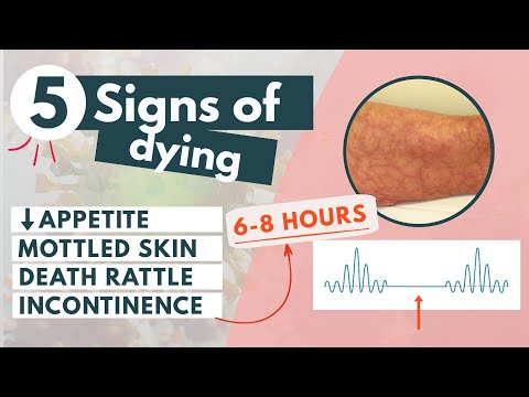 How to recognize a dying patient? | 5 signs of approaching death
