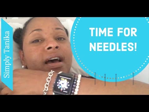 Acupuncture and HCG Trigger Shot. || Time for Needles! Video