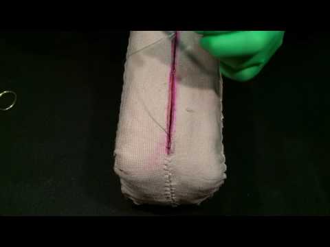 Burying the Knot at Start of Incision: Down and Out for Good