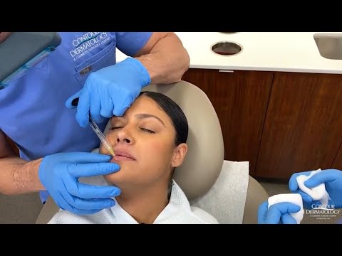 First Time Getting Lip Filler: Here's Why You Shouldn't Be Nervous!