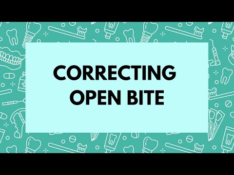 Management of Open bite -Orthodontics