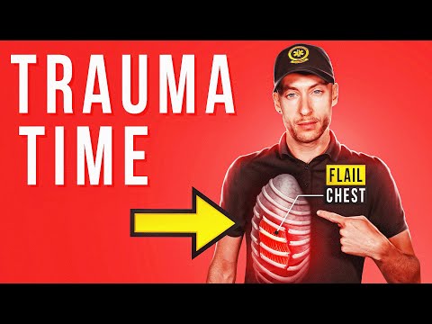 Rippenserienfraktur vs. Spannungspneumothorax