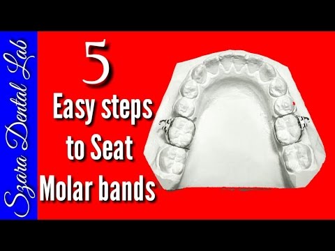 5 Easy steps Seating Ortho Bands