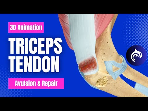 Guess The Spine Injury And Procedure Challenge