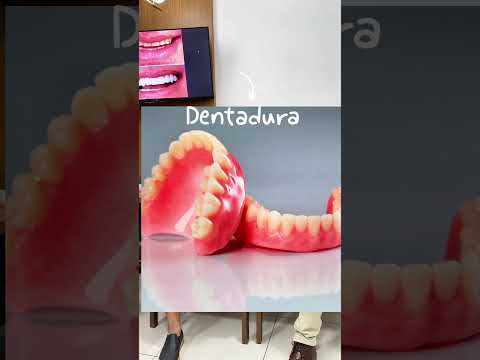 Paciente de Inhuma fez protocolo e mudou o sorriso! Veja esse depoimento